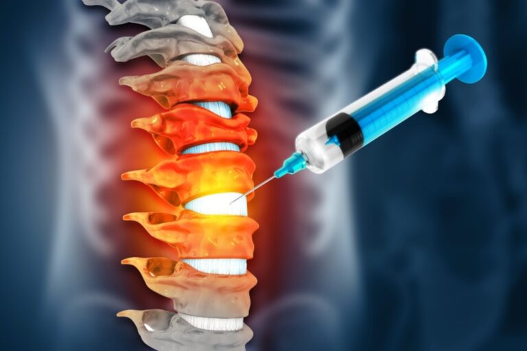 Post Med Injection How Long Do Steroid Injections Last? | NJ Pain Doctor