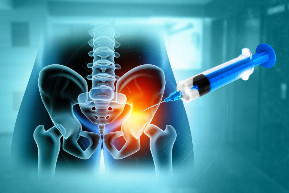 PRP injection on hip graphic