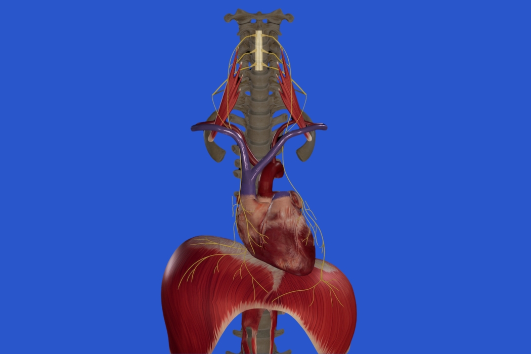 Phrenic Nerve Damage Graphic