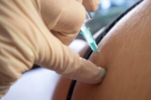 nerve blocks image example