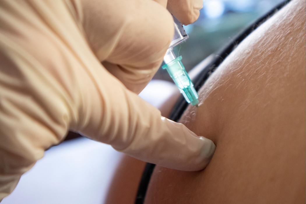 nerve blocks image example