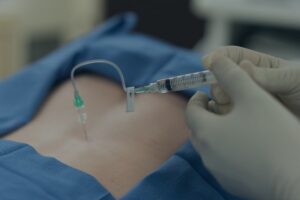 injection in place