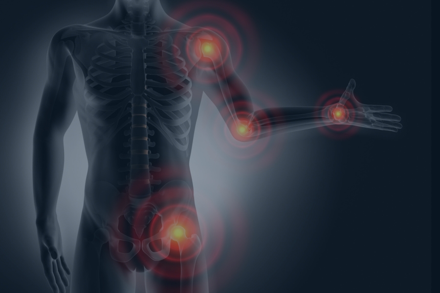 Inflammatory Pain graphic