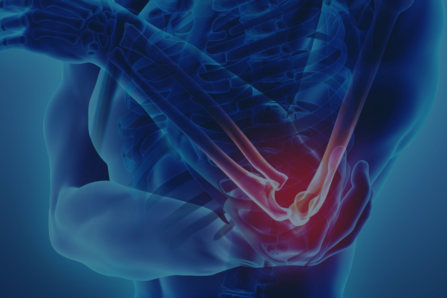 Rheumatoid Arthritis and Nerve Pain graphic