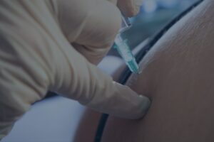 candidate for nerve block