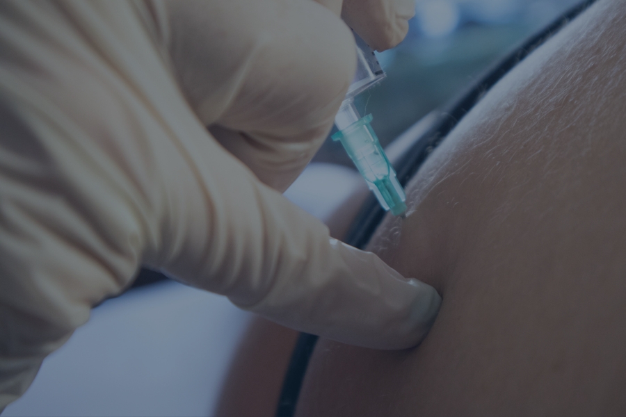 candidate for nerve block