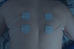 candidate for spinal cord stimulator