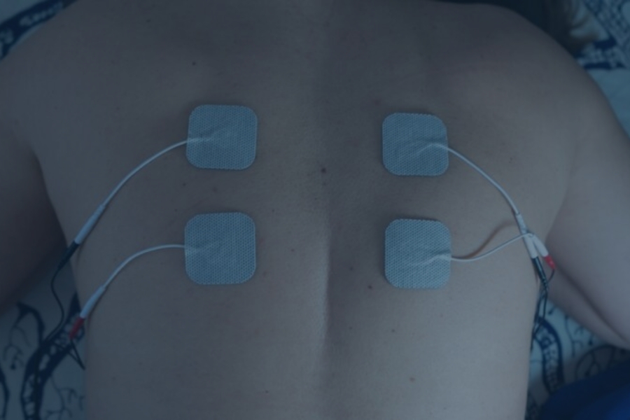 candidate for spinal cord stimulator