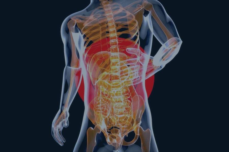 Discogenic Back Pain graphic