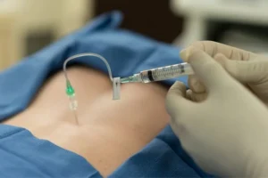 how often epidural injections